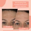 Forehead Wrinkle Patch | Reusable Skin Plumping Forehead Mask