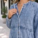 Alana Raw Hem Dress