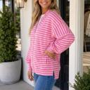  Ivanna Puff Sleeve Zip Jacket
